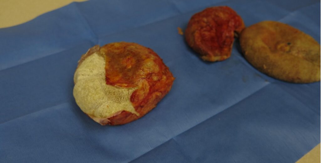 Medical procedure image