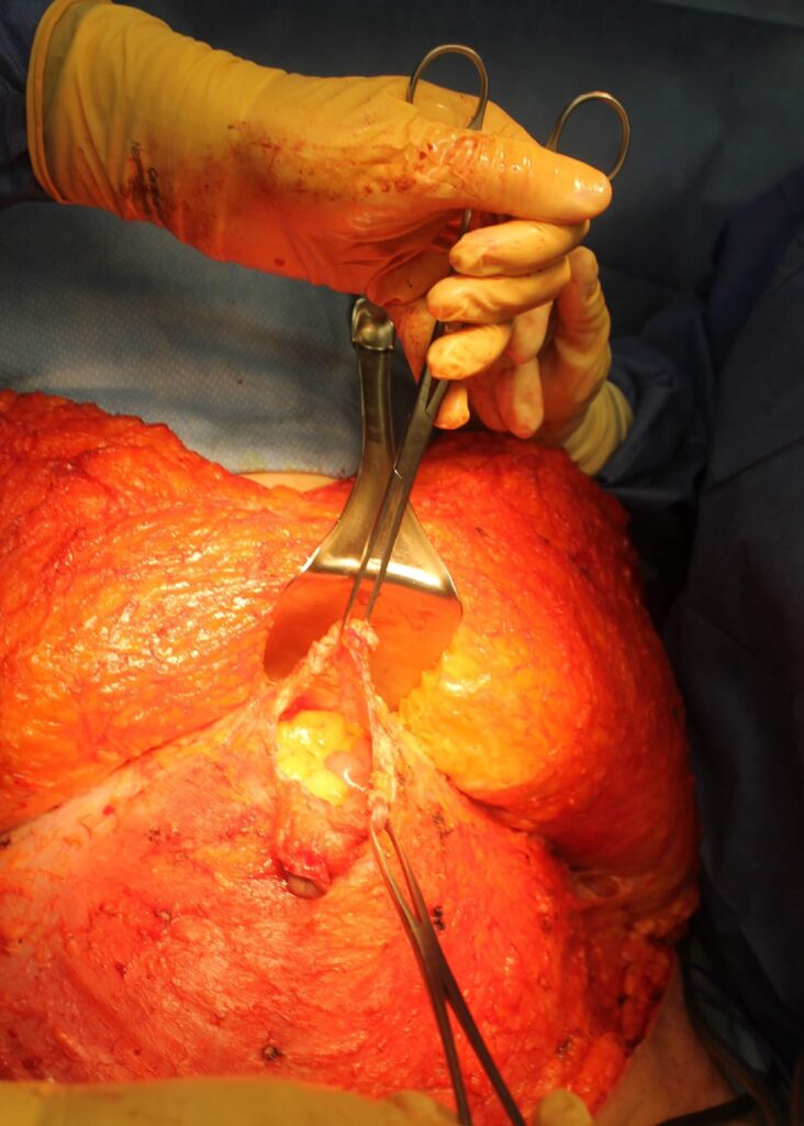 Medical procedure image