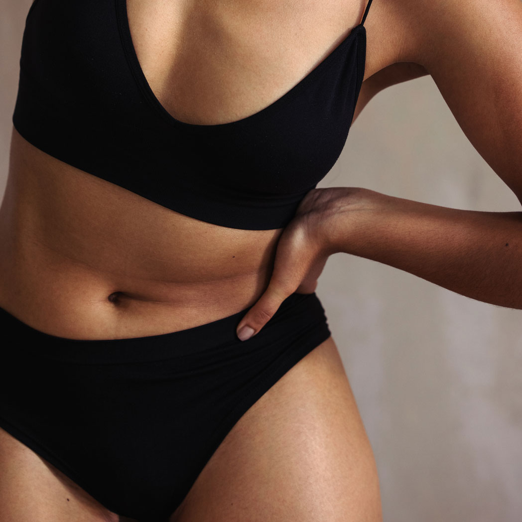 Abdominoplasty with Prior Complicated Umbilical Hernia Repair in Raleigh NC