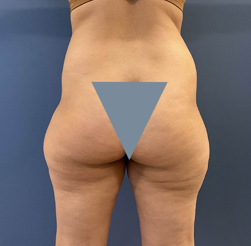 Lyle-Innerpage-B&A