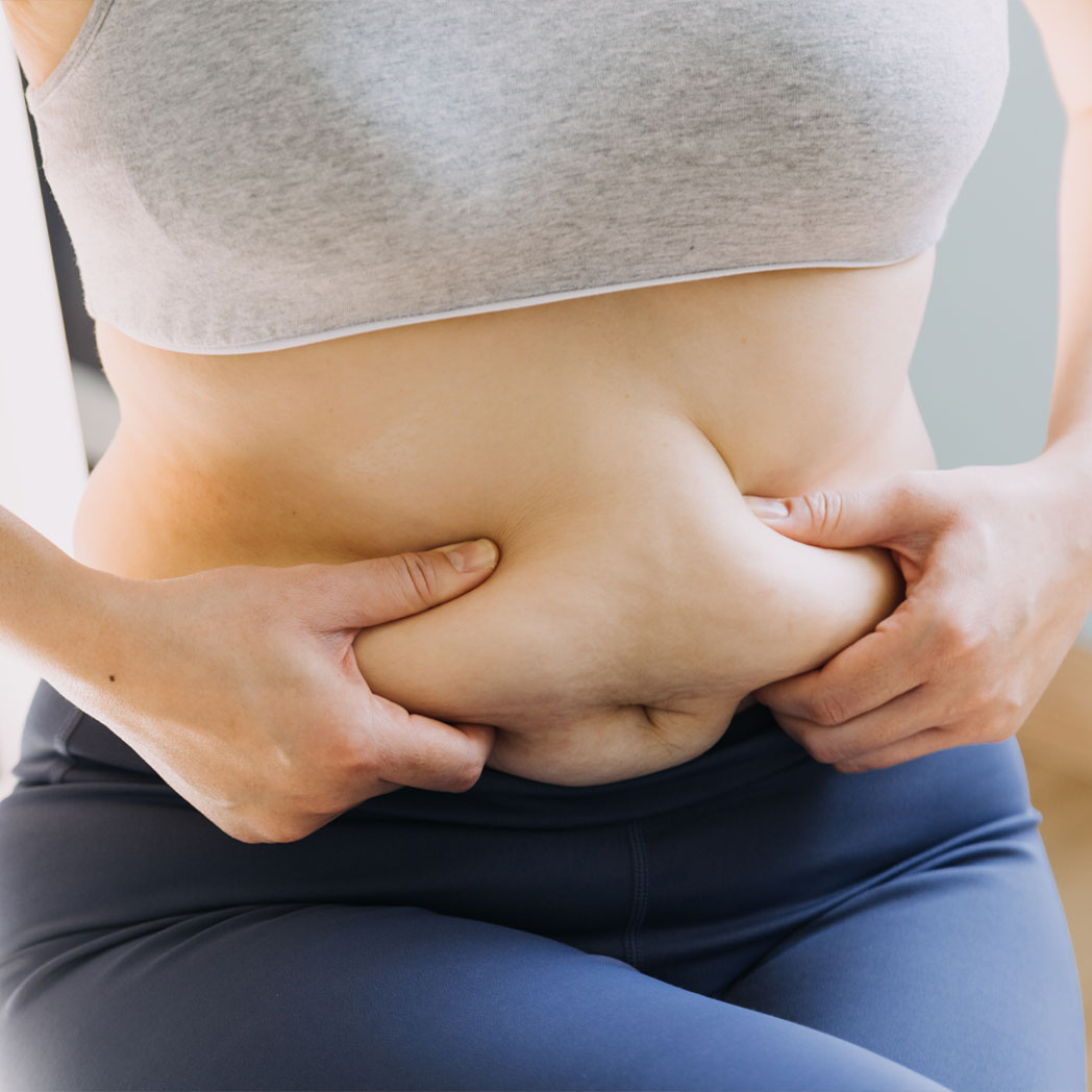 What Are Love Handles and How Can You Reduce Them?
